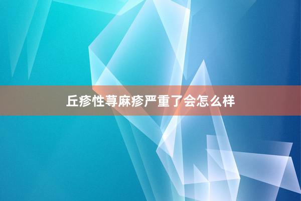 丘疹性荨麻疹严重了会怎么样